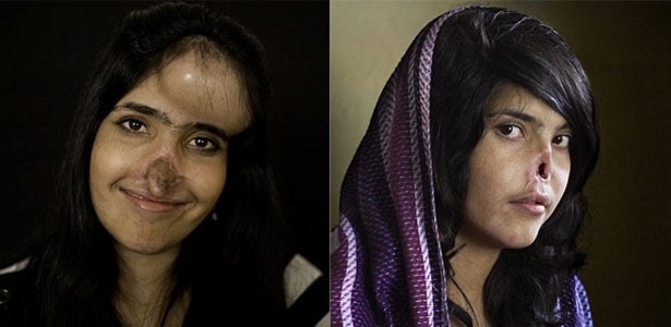 A afegã Aesha Mohammadzai hoje em dia e em 2010, quando foi fotografada pela revista Time