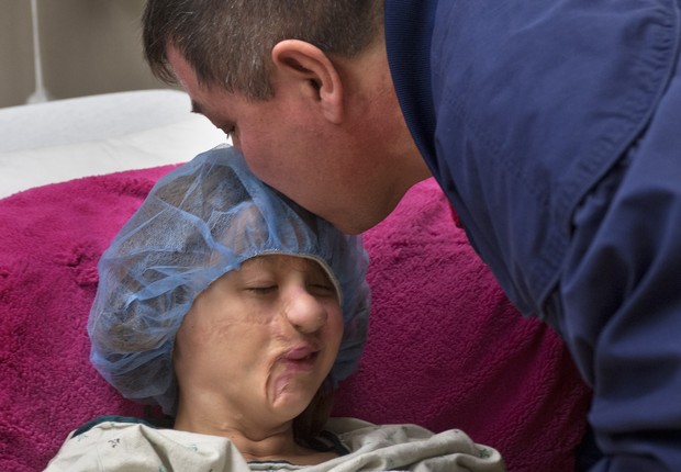 Charlotte Ponce ganha um beijo do pai, antes da cirurgia para a reconstrução da orelha (Foto: The Grand Rapids Press, Chris Clark/AP)