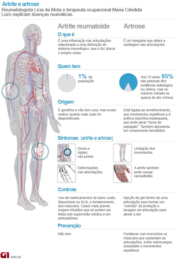 Artrite e artrose valendo (Foto: Arte/G1)