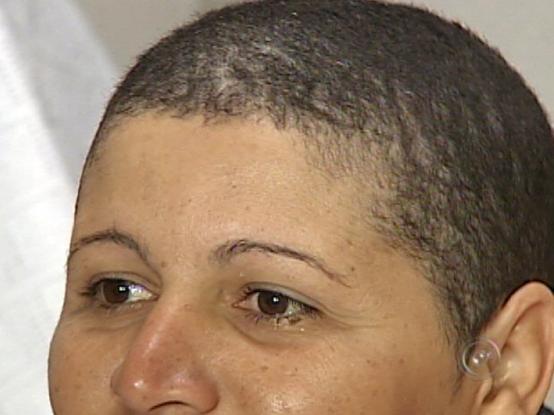 Mulher fica careca após usar produto para alisar cabelo em Sorocaba, SP (Foto: Reprodução TV Tem)