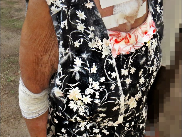 A idosa de 73 anos que mora em Colinas ficou ferida em diversas partes do corpo (Foto: Almino Borges/PM-TO)